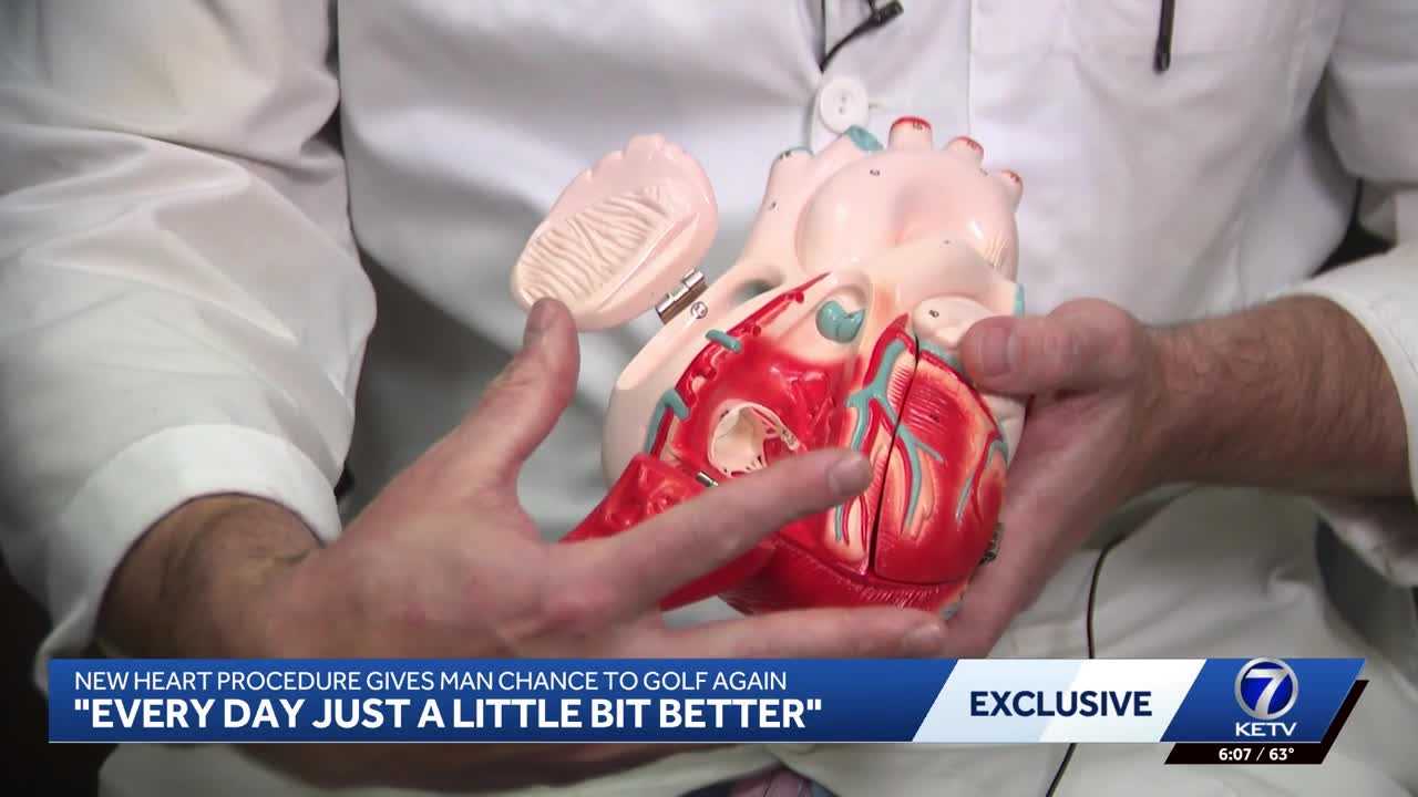 New heart procedure helps man swing a golf club again — WISN 12 Milwaukee, Garrison Community news